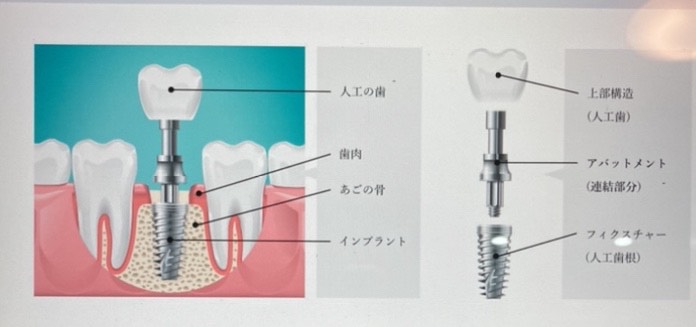 ダウンロード (3)